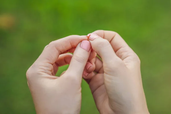 Unha quebrada em uma mão de mulheres com uma manicura em um contexto verde — Fotografia de Stock