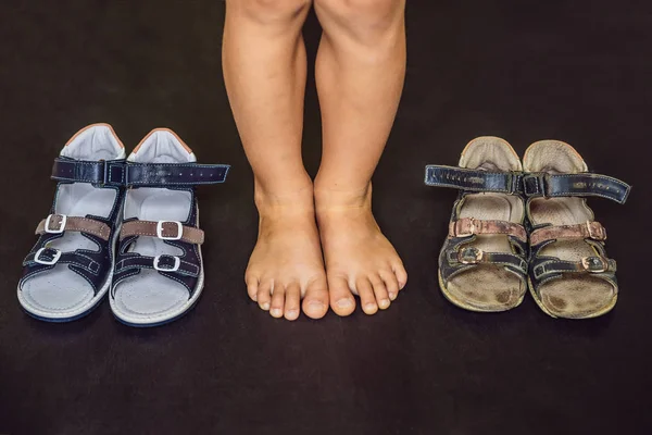 Child feet and old and new childish orthopedic sandals with arch support on dark surface.