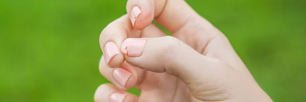 Gebrochener Nagel Auf Weiblicher Hand Mit Rosa Maniküre Auf Grünem — Stockfoto