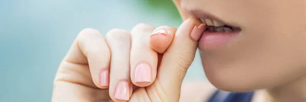 Woman biting broken nail on hand with manicure