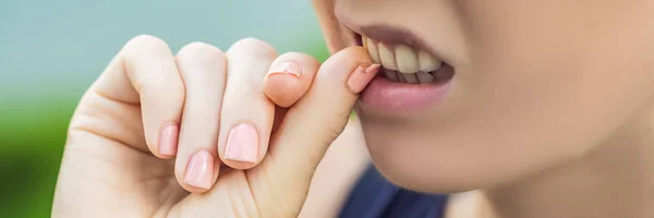 Woman biting broken nail on hand with manicure