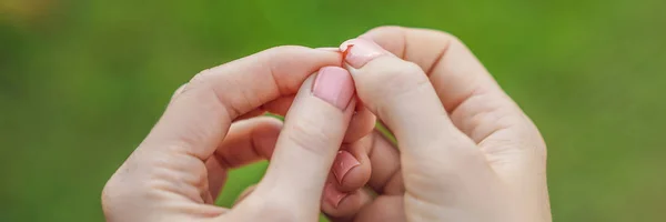 Trasig Nagel Kvinnliga Händer Med Rosa Manikyr Grön Bakgrund — Stockfoto