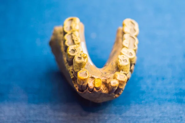 Teeth of an ancient man. Human evolution is the evolutionary process that led to the emergence of anatomically modern humans