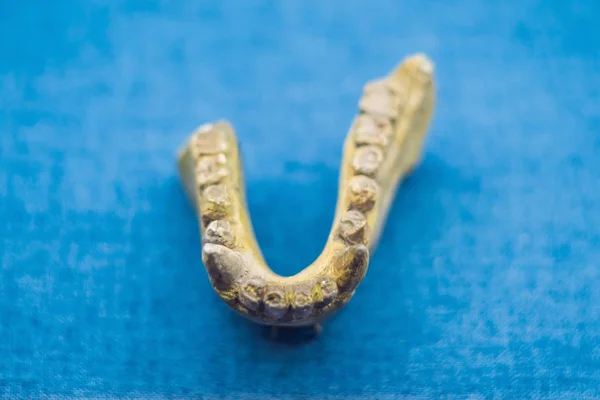 Teeth of an ancient man. Human evolution is the evolutionary process that led to the emergence of anatomically modern humans — Stock Photo, Image