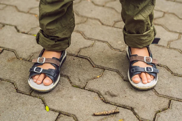 Feet of boy in orthopedic sandals on tiled road
