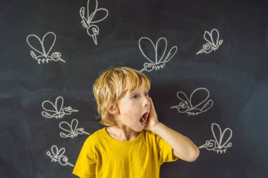 Çocuk karanlık bir arka plan üzerinde sivrisinekler tarafından ısırıldı. Tahtaya tebeşir sivrisinekler boyalı ile