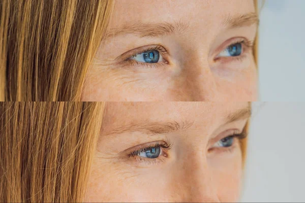 Сравнение женских глаз до и после наращивания ресниц — стоковое фото
