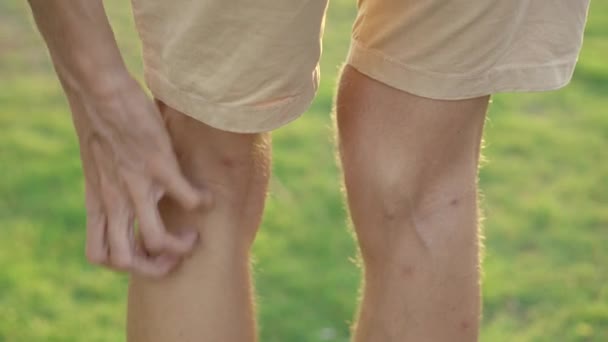 Чоловік на природному тлі подряпає ноги, які сильно кусали комарі. Концепція кусаючих комах — стокове відео