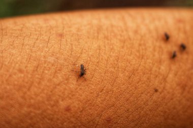 Karıncalar deriye kan emiyor.