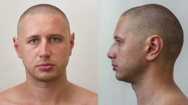 Time-lapse - process of growing a beard and hair of young caucasian man - side and front side — Stock Video