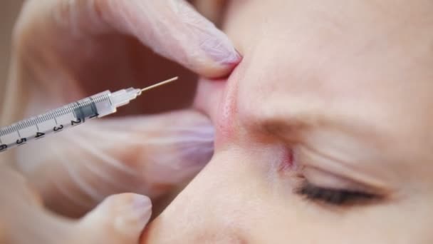 Femme dans une clinique de cosmétologie. Spécialiste colle dans une aiguille dans le front des clients — Video