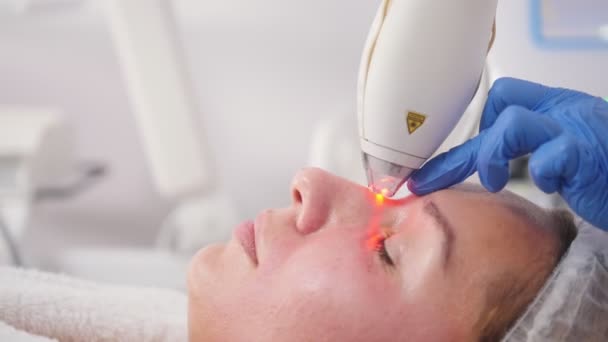 Procedimientos de cosmetología. Limpieza de poros. Trabajar con unstrument especial en la nariz . — Vídeo de stock