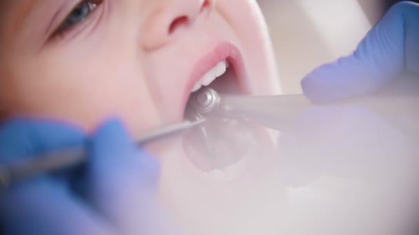 Tandvård. Kvinnliga tandläkare polering tänder av lilla bebis — Stockvideo
