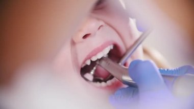 Diş Hekimliği. Ağır çekimde küçük bebeğin diş parlatma kadın diş hekimi