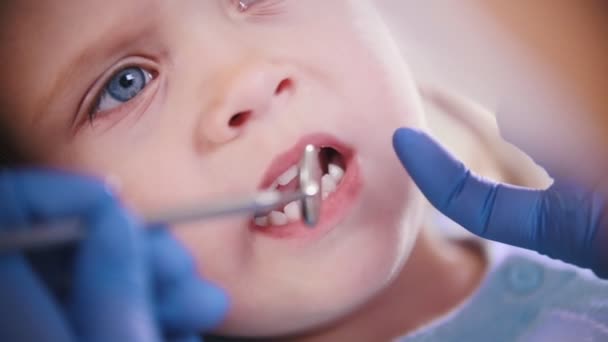 Odontoiatria. La dentista femminile esamina i denti del piccolo bambino. Da vicino. — Video Stock