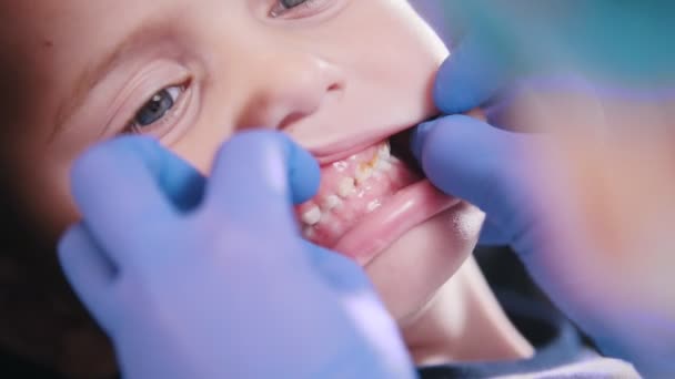 Zubní lékařství. Zubní lékař zkoumá baby malé zuby. Detailní záběr