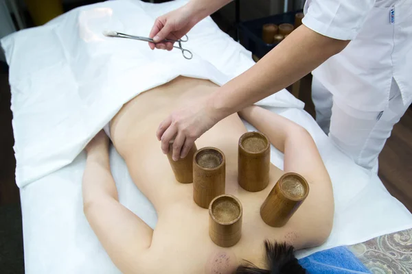 Una donna che prende un trattamento di medicina alternativa. Procedura di Moxoterapia — Foto Stock