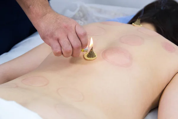 Une femme qui suit un traitement de médecine alternative. Procédure de moxo thérapie. Chauffage des points de réflexologie avec des cigares d'absinthe. Thérapeute professionnel faisant de la thérapie traditionnelle chinoise - chauffage — Photo