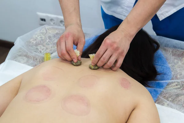 Une femme qui suit un traitement de médecine alternative. Procédure de moxo thérapie . — Photo