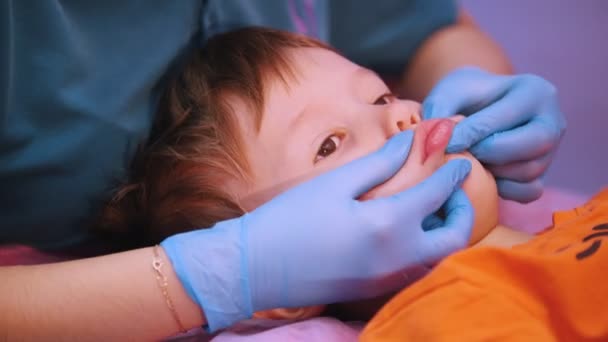 Centro médico. Un bebé con parálisis cerebral que recibe un masaje facial — Vídeos de Stock