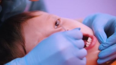 Tıp Kliniği. Beyin felci hastalığı olan bir bebek. Konuşma terapisi Masaj, ağız özel araç ile bir kadın çalışıyor. Yakın çekim