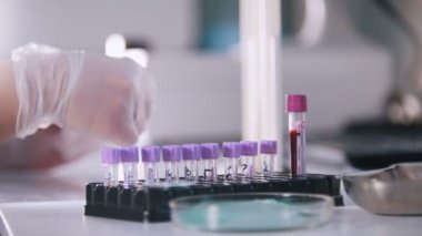 Sağlık kliniği. Bir kan testi. Bir hemşire vitro kandan alır
