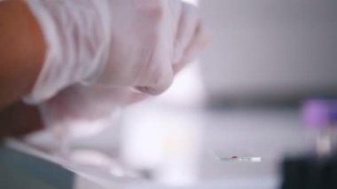 Sağlık kliniği. Bir kan testi yaptıkları bir hemşire