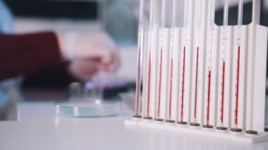 Sağlık kliniği. Hemşire kan örnekleri ile çalışır. Pipetler kanla dolu yakın çekim