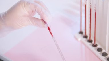 Sağlık kliniği. Hemşire kan örnekleri ile çalışır. Pipet kan ile dolduruyor