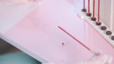 Sağlık kliniği. Bir kan testi. Camına kan damlayan ve camına örnek taşlama