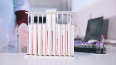 Sağlık kliniği. Pipetler ile mahkemeye hemşire test tüpleri ile stand yakın kan ile dolu