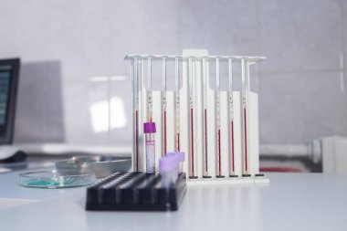 Sağlık kliniği. Pipetler Ayaklıklı kanla dolu. Kan örnekleri