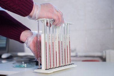 Sağlık kliniği. Pipetler Ayaklıklı kanla dolu. Onu çekici bir hemşire