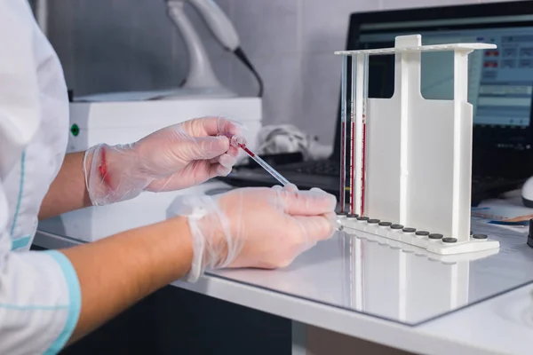 Медицинская клиника Медсестра на своем рабочем месте. Наполнение пипетки кровью из трубки — стоковое фото