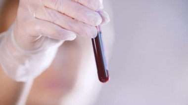 Sağlık kliniği. Kanla dolu bir test tüpü tutan hemşire. Yakın çekim