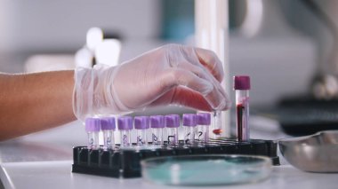 Bir kadın tıbbi laboratuvar şişesi ile çalışma