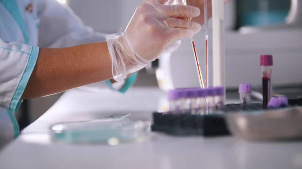 Una mujer está analizando una sangre en un laboratorio médico —  Fotos de Stock