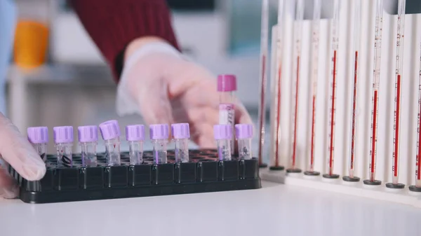 Una hembra usó diferentes muestras de sangre para pruebas en el laboratorio médico —  Fotos de Stock