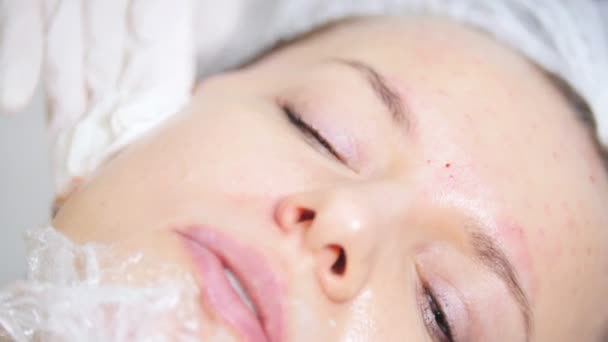 Schoonheidsspecialist cosmetische procedure van Mesotherapie van het gezicht vegen klanten gezicht in cosmetologie kliniek doen. Close-up — Stockvideo
