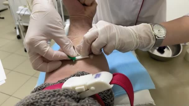 Μια νοσοκόμα, λαμβάνοντας ένα δείγμα αίματος από το ένα χέρι για τη δοκιμή — Αρχείο Βίντεο