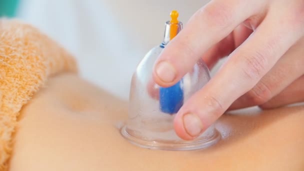 Massagesitzung. ein Masseur gibt einer jungen Frau eine Vakuummassage — Stockvideo