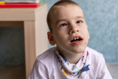 Dairesinin koşullarında beyin felci geçiren bir çocuk. Çevresindeki her şeye canlı bir şekilde tepki veriyor ve bunu kişiliğiyle gösteriyor..