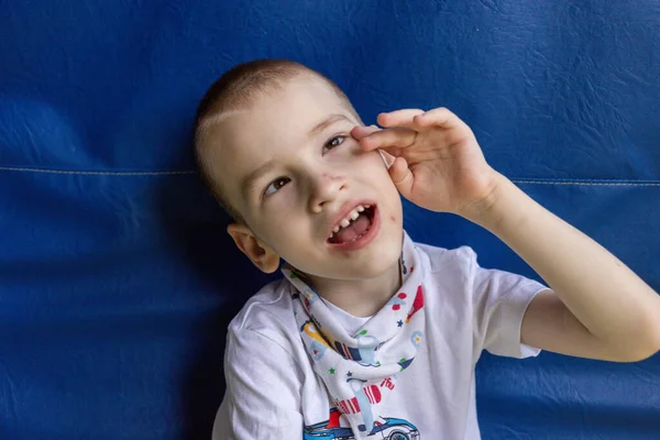 Dairesinin koşullarında beyin felci geçiren bir çocuk. Çevresindeki her şeye canlı bir şekilde tepki veriyor ve bunu kişiliğiyle gösteriyor..