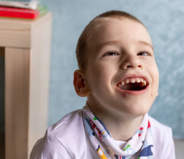 Dairesinin koşullarında beyin felci geçiren bir çocuk. Çevresindeki her şeye canlı bir şekilde tepki veriyor ve bunu kişiliğiyle gösteriyor..