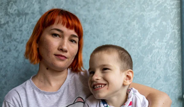 Serebral felçli bir çocuk ve dairesinin koşullarında annesi. Çocuk etrafındaki her şeye canlı bir şekilde tepki veriyor ve bunu kişiliğiyle gösteriyor..