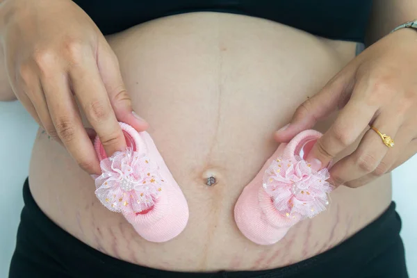 Small Shoes Unborn Baby Belly Pregnant Woman — Stock Photo, Image