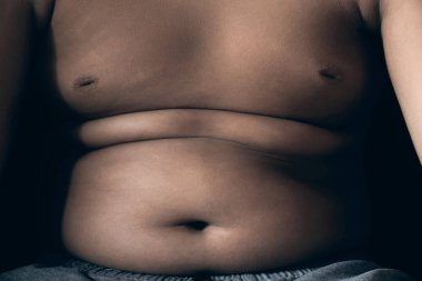 Siyah arka plan üzerinde şişman çocuğun vücut kadar yakın, kilo ve sağlık kavramı kaybetmek.