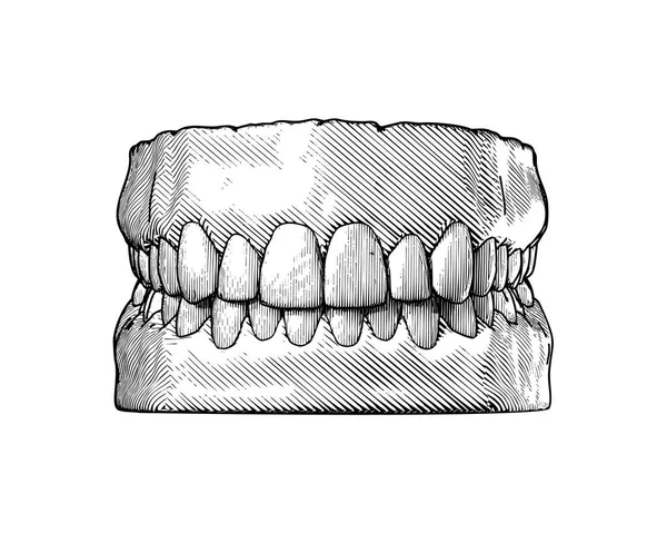 Монохромная Винтажная Гравировка Рисунок Зуба Десны Плотная Челюсть Представляют Зубной — стоковый вектор