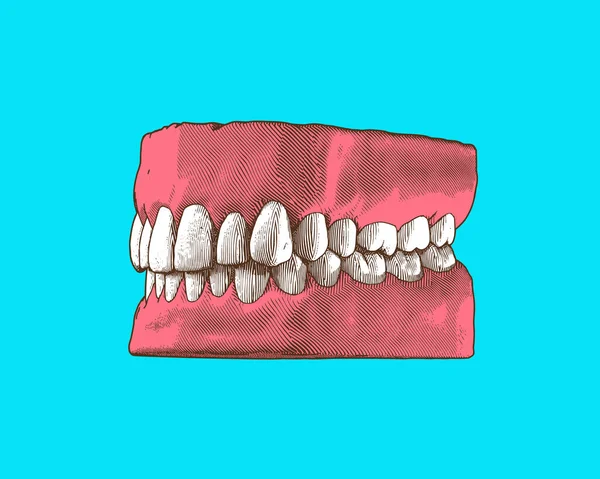 カラフルなヴィンテージ彫刻の描画歯とガムの近くの顎は パースペクティブ側のカメラビューのイラストで歯の閉塞を表すレトロな緑のターコイズの背景に孤立 — ストックベクタ