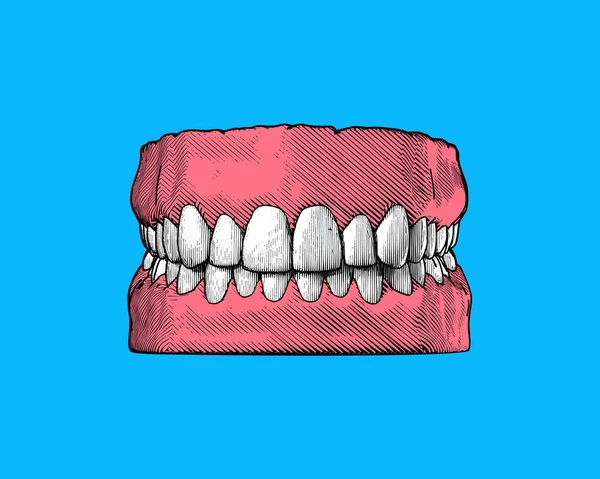 明るい青の背景に隔離されたフロントビューのイラストで歯の閉塞のためのカラフルなヴィンテージ彫刻の描画歯とガムの近くの顎を表します — ストックベクタ